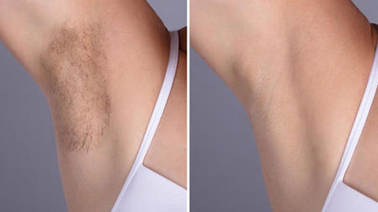 Estheticly Ca Laser Hair Removal Vancouver